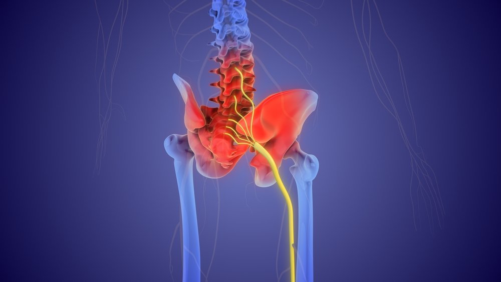 The,Medical,Concept,Of,Sciatic,Nerve,Pain,3d,Illustration what is sciatica? Sciatica treatment tyrone pa